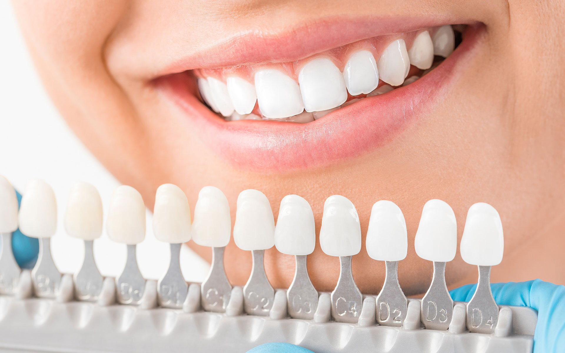 What Precautions should be taken after Oral Surgery?