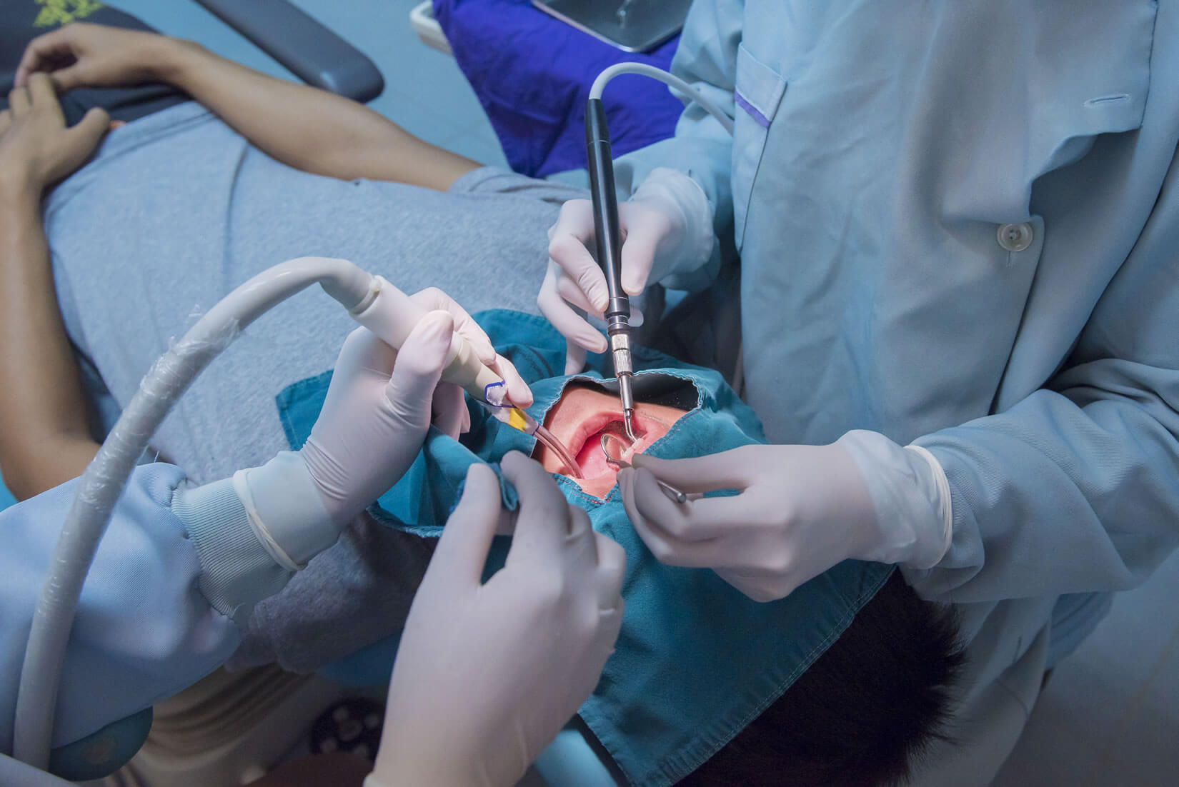What is Oral Surgery?
